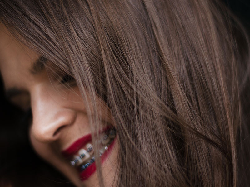 A woman wearing adult braces and smiling after listening to these dating tips from an orthodontist.
